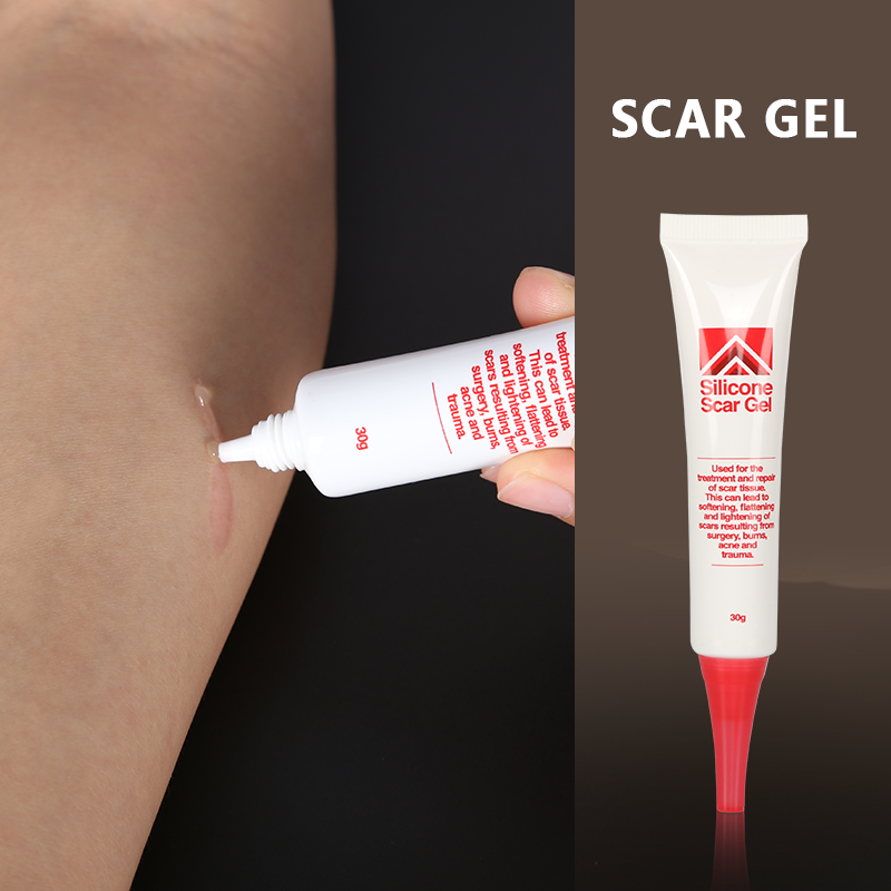 Supply Old Pregnancy Keloid Burn Surgical Sca - 4